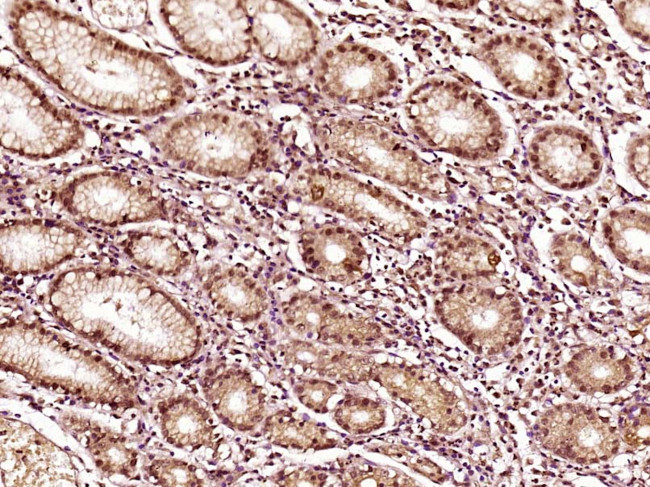 EVPLL Antibody in Immunohistochemistry (Paraffin) (IHC (P))