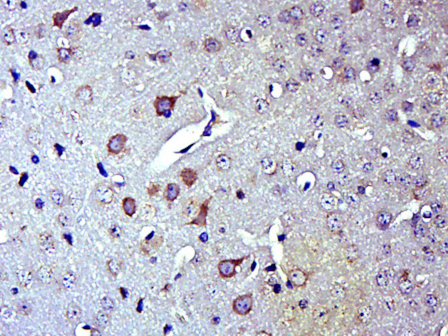 FAM108A1 Antibody in Immunohistochemistry (Paraffin) (IHC (P))