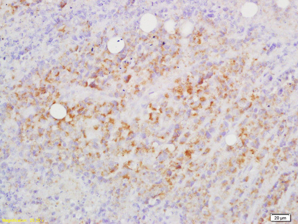 CD82/KAI1 Antibody in Immunohistochemistry (Paraffin) (IHC (P))