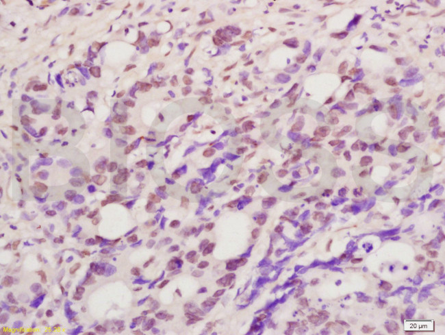 I16/MNDA Antibody in Immunohistochemistry (Paraffin) (IHC (P))