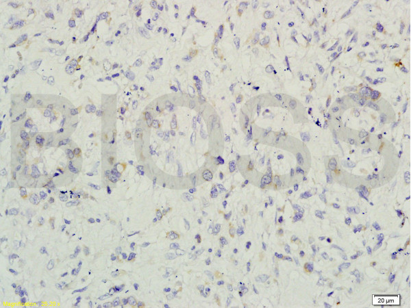 Gremlin 1 Antibody in Immunohistochemistry (Paraffin) (IHC (P))