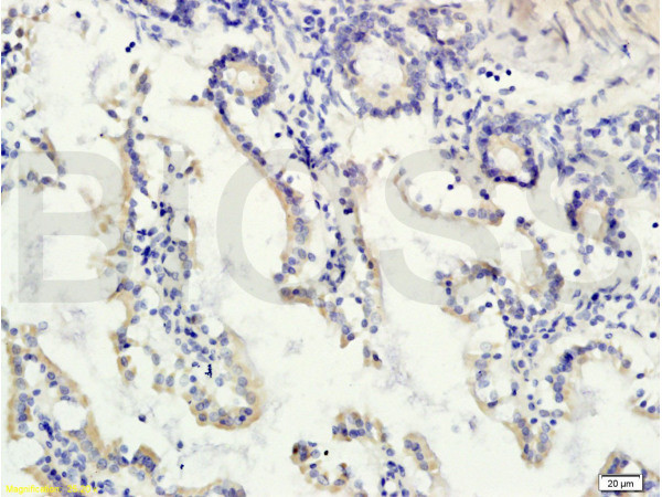 Gremlin 1 Antibody in Immunohistochemistry (Paraffin) (IHC (P))