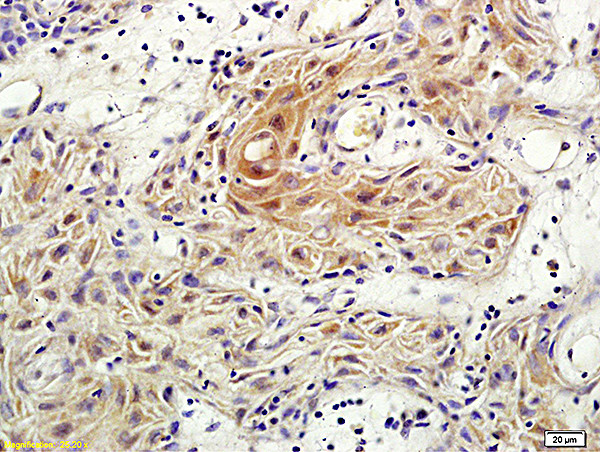 Rho C Antibody in Immunohistochemistry (Paraffin) (IHC (P))