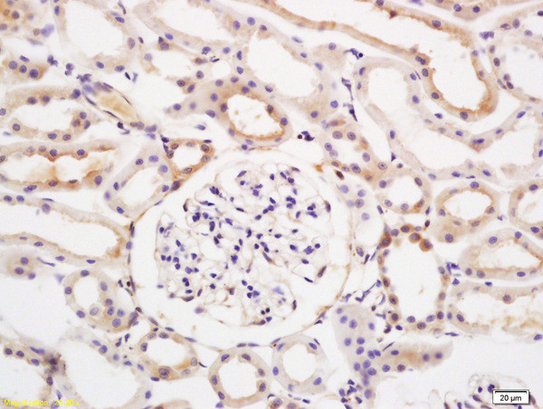 E2AK2/PKR Antibody in Immunohistochemistry (Paraffin) (IHC (P))