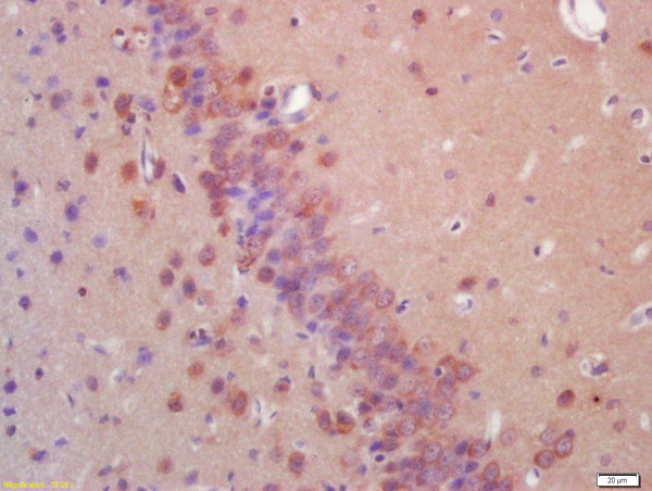 E2AK2/PKR Antibody in Immunohistochemistry (Paraffin) (IHC (P))