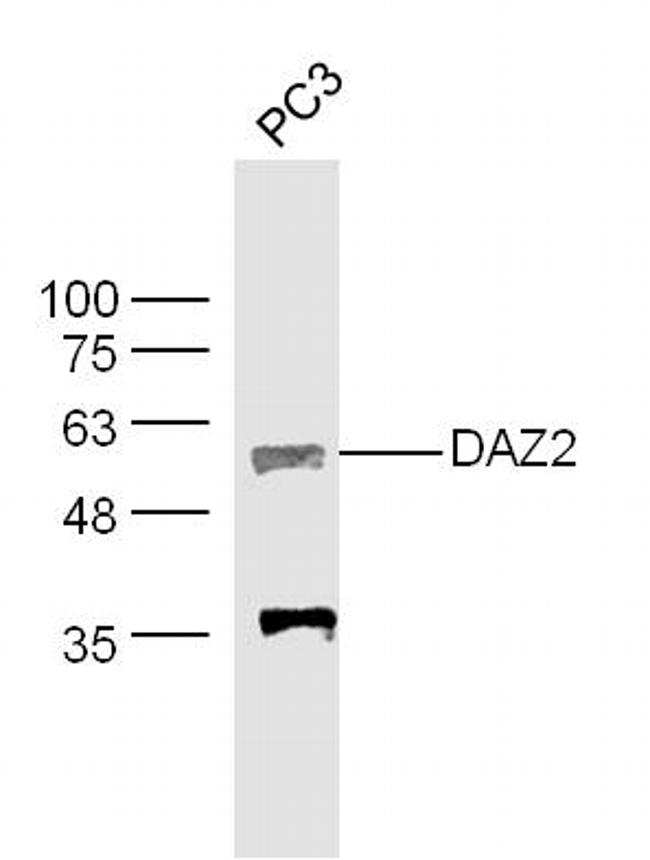DAZ2 Antibody in Western Blot (WB)