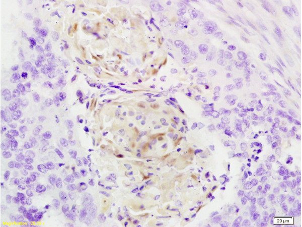 Cathepsin B Heavy Chain Antibody in Immunohistochemistry (Paraffin) (IHC (P))