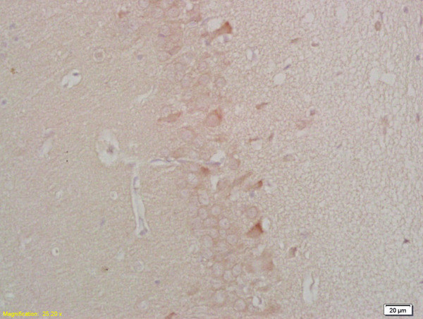 Rarres2 Antibody in Immunohistochemistry (Paraffin) (IHC (P))