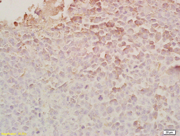 Rarres2 Antibody in Immunohistochemistry (Paraffin) (IHC (P))