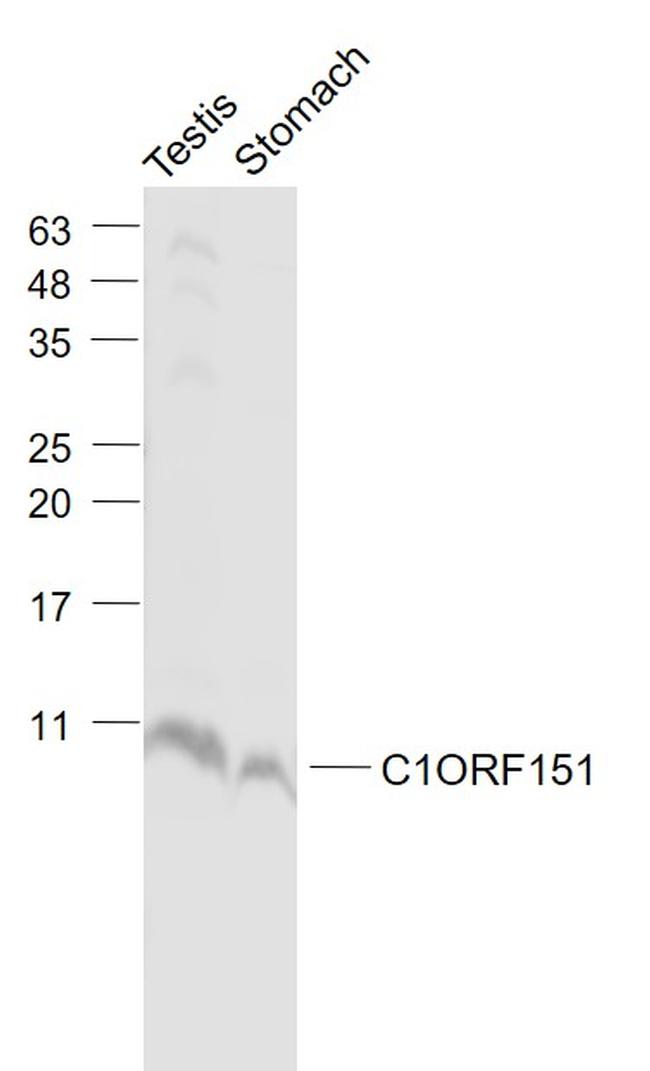 C1ORF151 Antibody in Western Blot (WB)