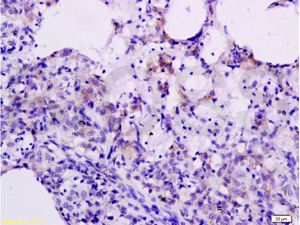 CXCL10 Antibody in Immunohistochemistry (Paraffin) (IHC (P))