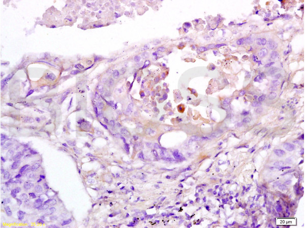 RAP1A Antibody in Immunohistochemistry (Paraffin) (IHC (P))