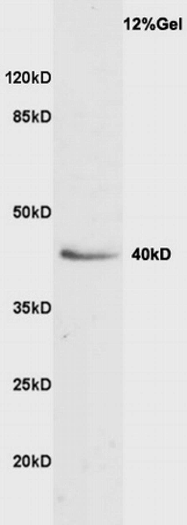 VASH1 Antibody in Western Blot (WB)