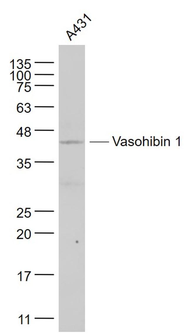 VASH1 Antibody in Western Blot (WB)