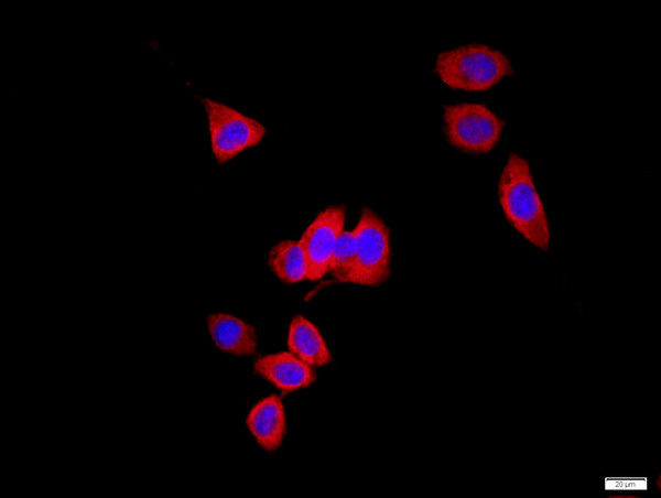 AQP1 Antibody in Immunocytochemistry (ICC/IF)