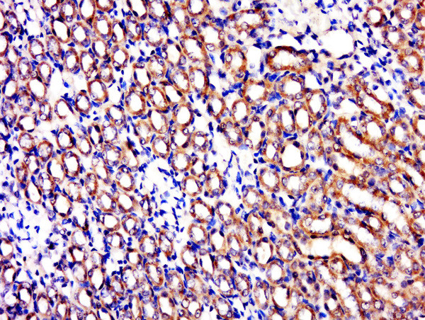 C1orf69 Antibody in Immunohistochemistry (Paraffin) (IHC (P))