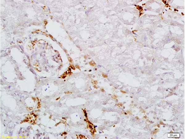 AAK1 Antibody in Immunohistochemistry (Paraffin) (IHC (P))