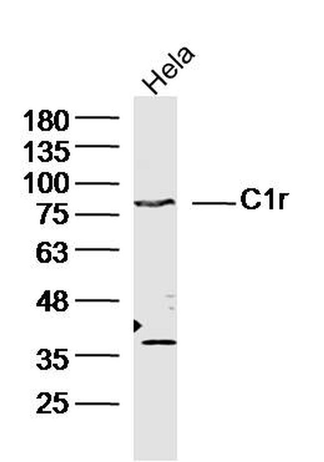 C1r Antibody in Western Blot (WB)