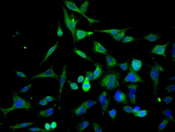 Cathepsin L Antibody in Immunocytochemistry (ICC/IF)