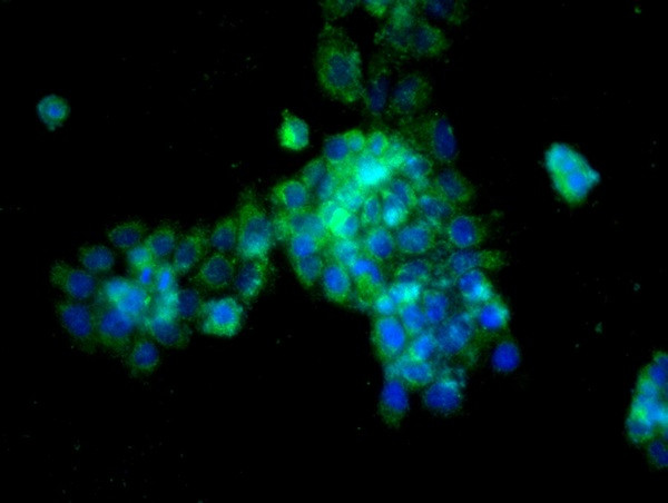 Cathepsin L Antibody in Immunocytochemistry (ICC/IF)