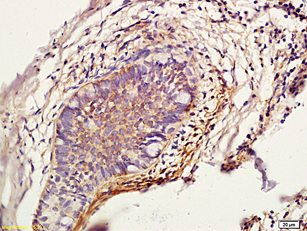 Cathepsin L Antibody in Immunohistochemistry (Paraffin) (IHC (P))