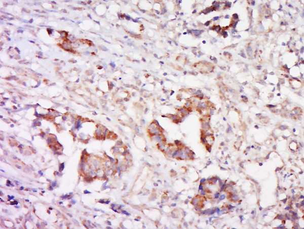 Cathepsin L Antibody in Immunohistochemistry (Paraffin) (IHC (P))