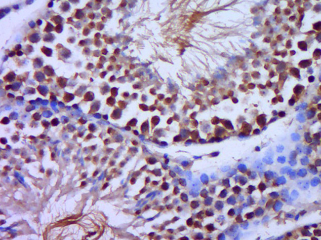 C20orf79 Antibody in Immunohistochemistry (Paraffin) (IHC (P))