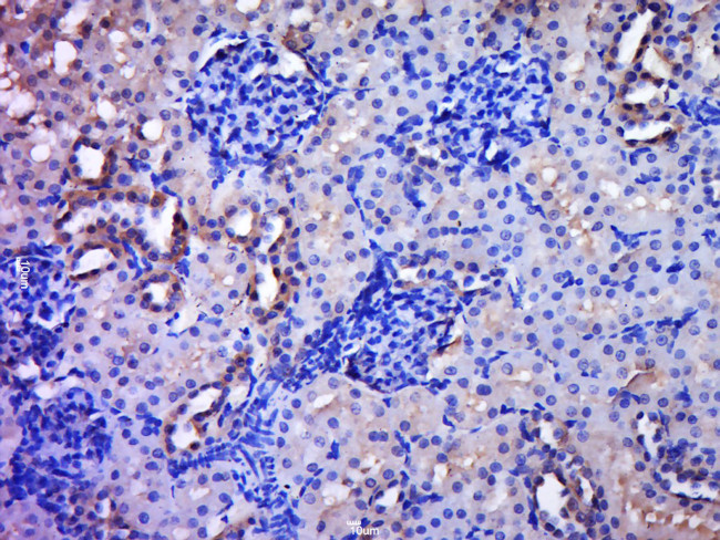 C20orf96 Antibody in Immunohistochemistry (Paraffin) (IHC (P))