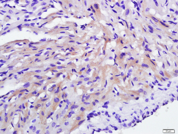 C21orf33 Antibody in Immunohistochemistry (Paraffin) (IHC (P))