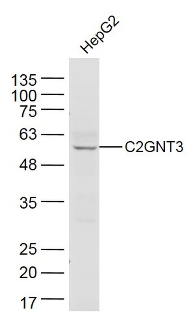 C2GNT3 Antibody in Western Blot (WB)