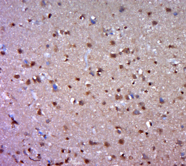 C3orf25 Antibody in Immunohistochemistry (Paraffin) (IHC (P))