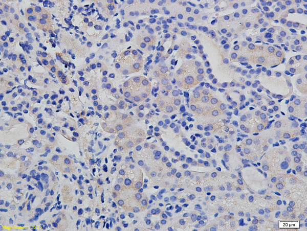 pan Cadherin Antibody in Immunohistochemistry (Paraffin) (IHC (P))