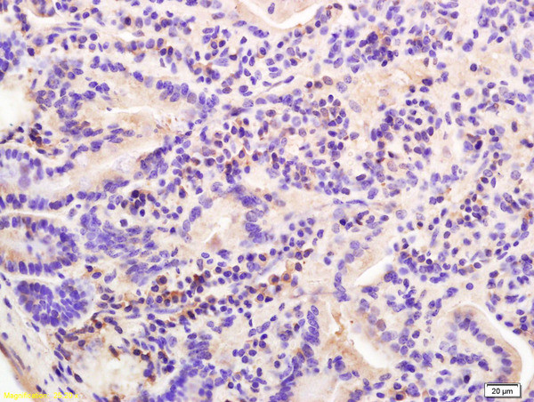 pan Cadherin Antibody in Immunohistochemistry (Paraffin) (IHC (P))