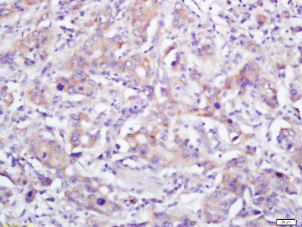 pan Cadherin Antibody in Immunohistochemistry (Paraffin) (IHC (P))