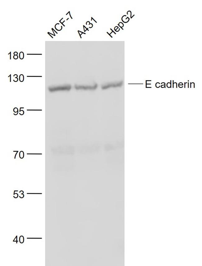 pan Cadherin Antibody in Western Blot (WB)