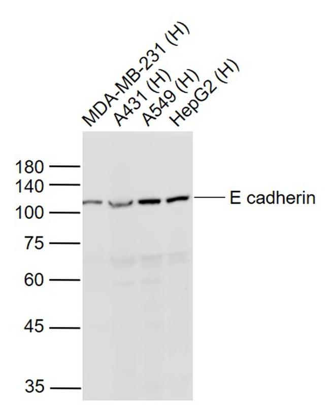 pan Cadherin Antibody in Western Blot (WB)