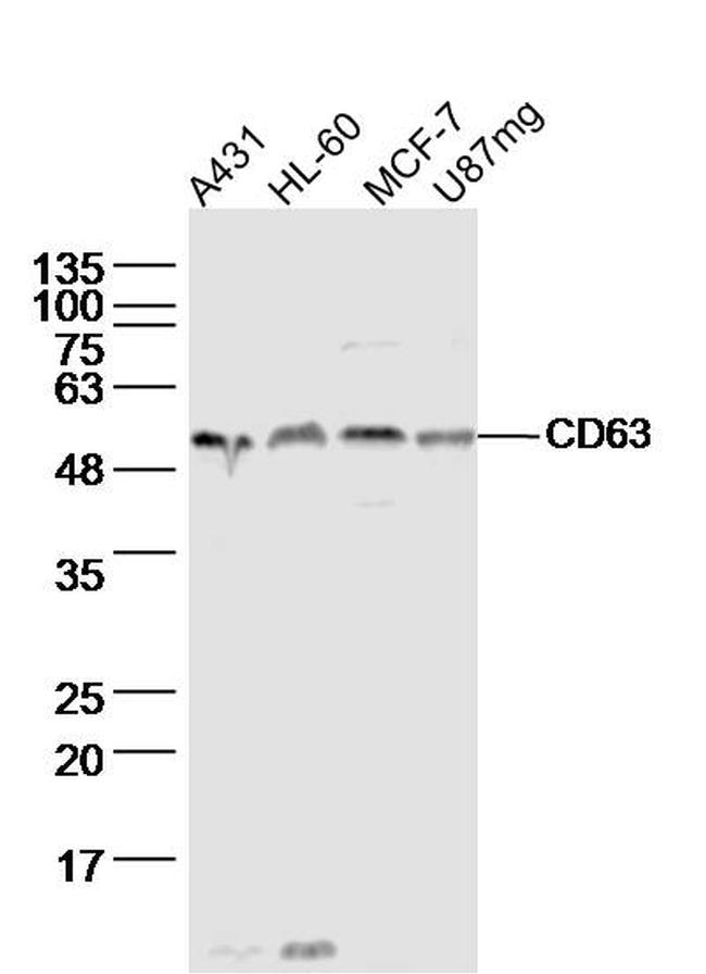 CD63/MLA1 Antibody in Western Blot (WB)