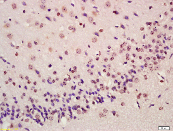 ATF4/CREB-2 Antibody in Immunohistochemistry (Paraffin) (IHC (P))