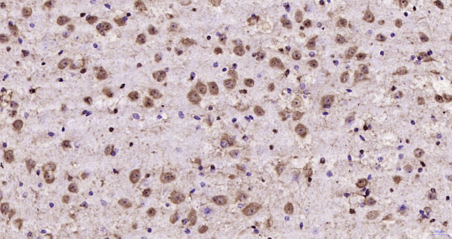 ATF4/CREB-2 Antibody in Immunohistochemistry (Paraffin) (IHC (P))