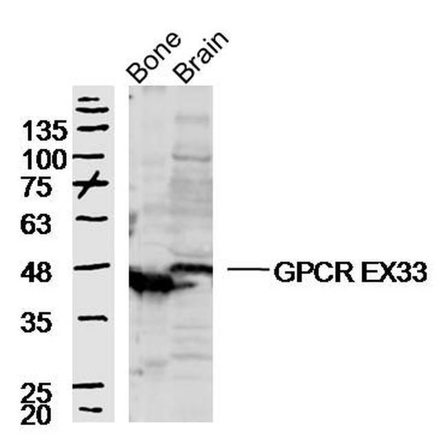 GPCR EX33 Antibody in Western Blot (WB)