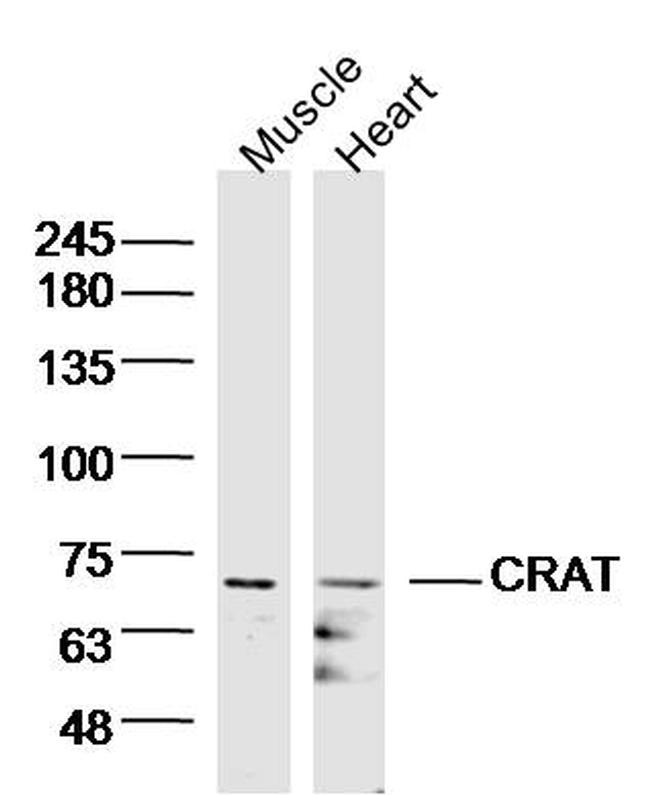 CRAT/CAT1 Antibody in Western Blot (WB)