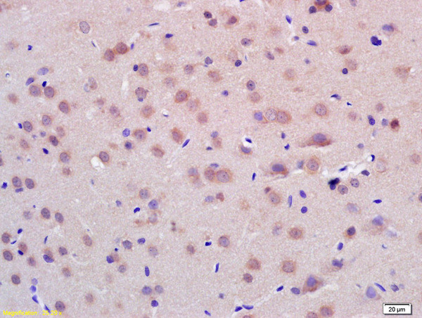 CHIP Antibody in Immunohistochemistry (Paraffin) (IHC (P))