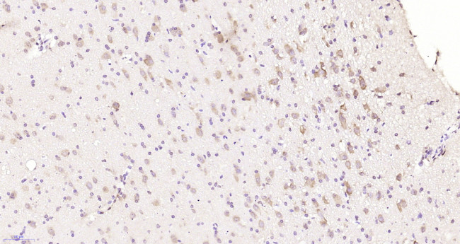 CHIP Antibody in Immunohistochemistry (Paraffin) (IHC (P))