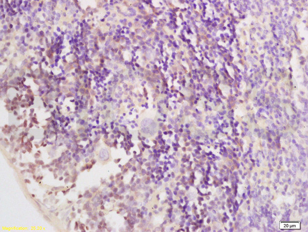 CCR6/CD196 Antibody in Immunohistochemistry (Paraffin) (IHC (P))