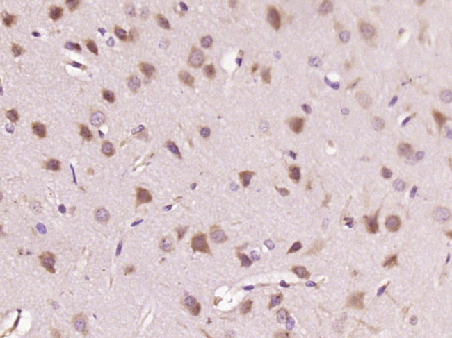 HDPTP Antibody in Immunohistochemistry (Paraffin) (IHC (P))