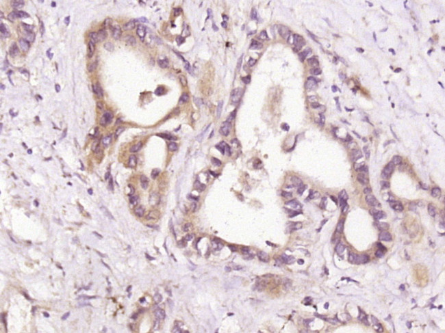 HDPTP Antibody in Immunohistochemistry (Paraffin) (IHC (P))