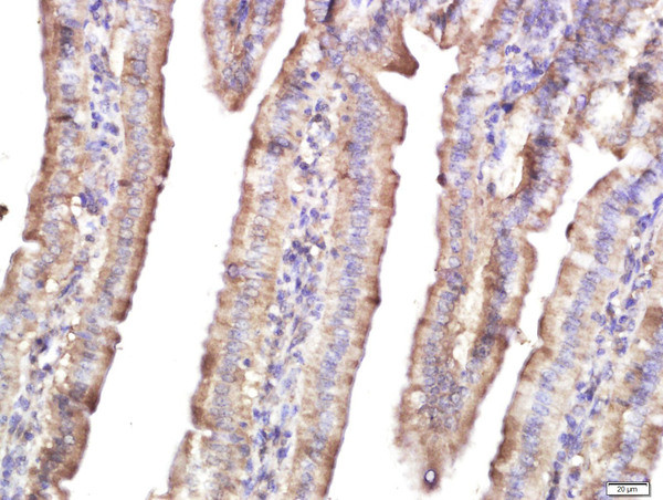 HEG1 Antibody in Immunohistochemistry (Paraffin) (IHC (P))