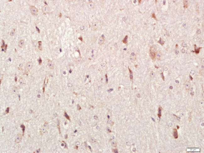 HEG1 Antibody in Immunohistochemistry (Paraffin) (IHC (P))