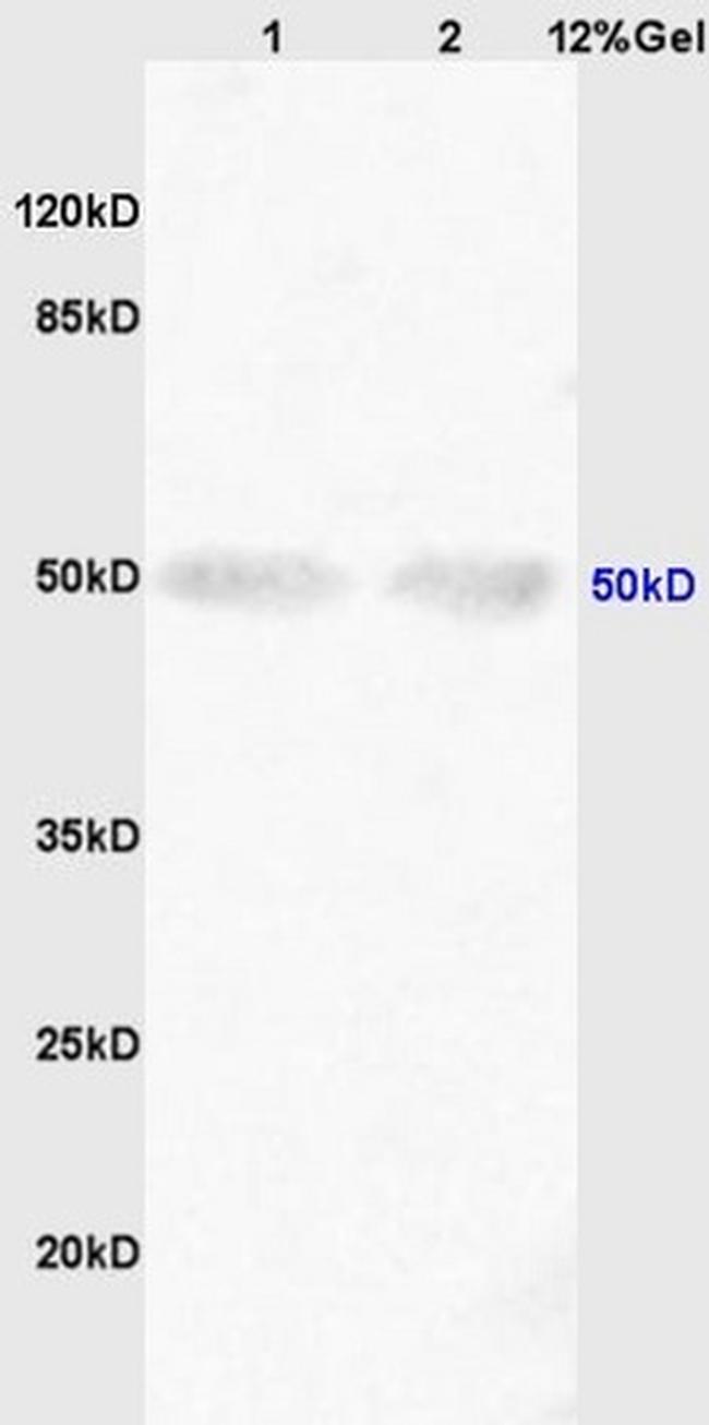 Shh Antibody in Western Blot (WB)