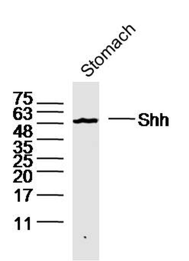 Shh Antibody in Western Blot (WB)